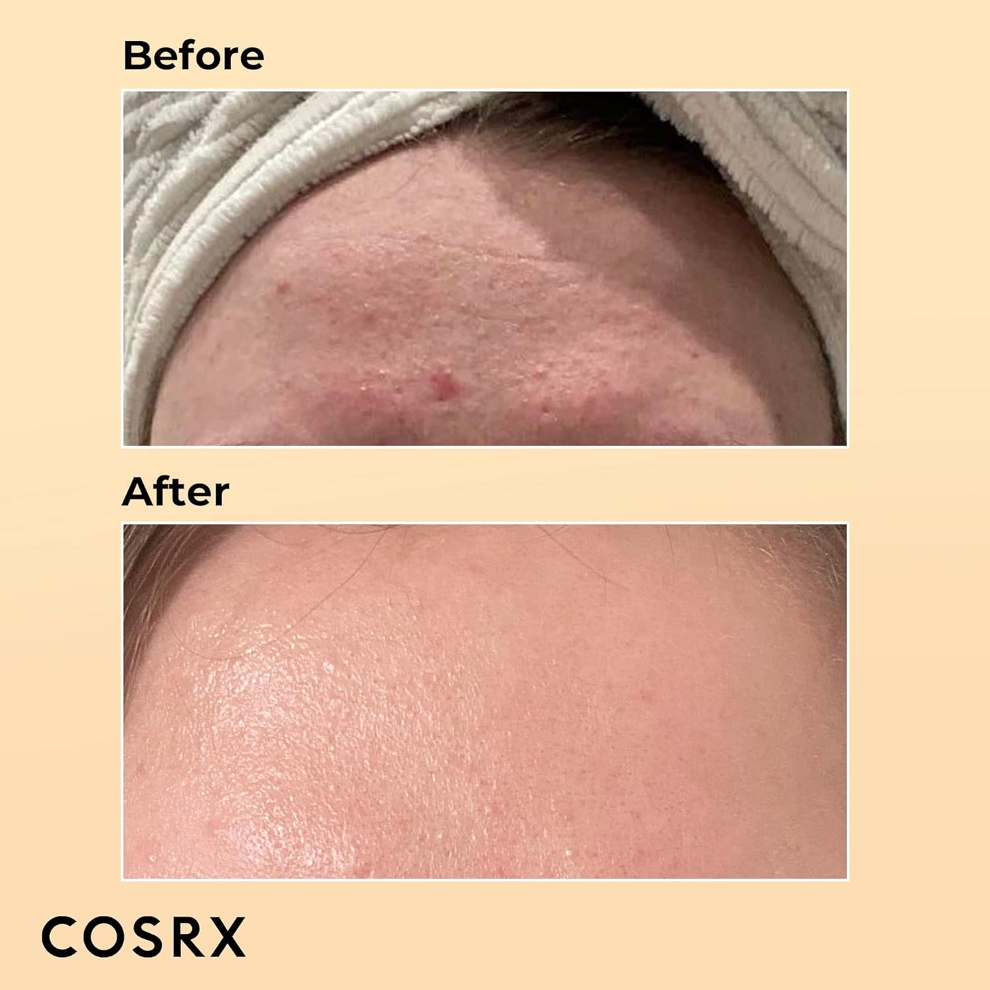 Glow-Up Snail Serum