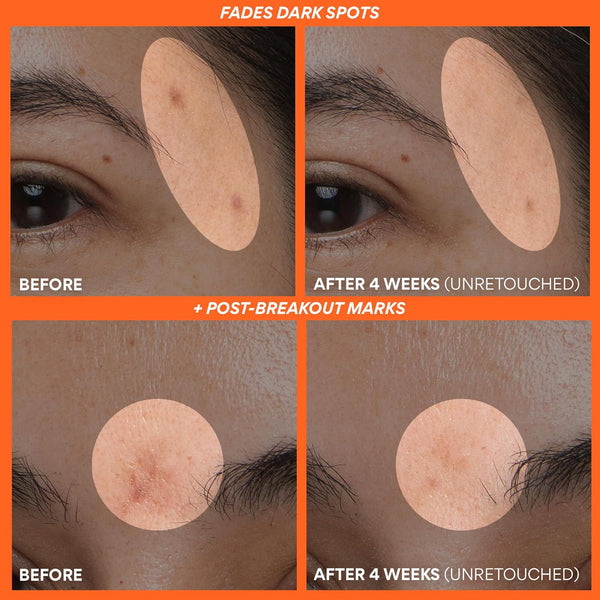 Radiant Glow Elixir Serum